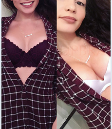 Upbra before and after