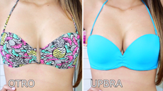 Upbra before and after