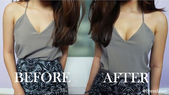 Before and after pics of Upbra Lift up bras